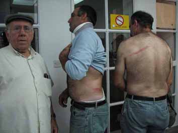 Posadas-Carga-policial-colada-Torilejos-7