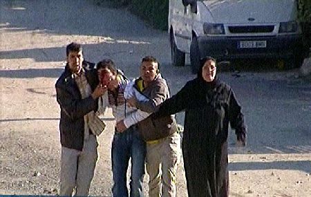 Imagenes de la brutalidad policial